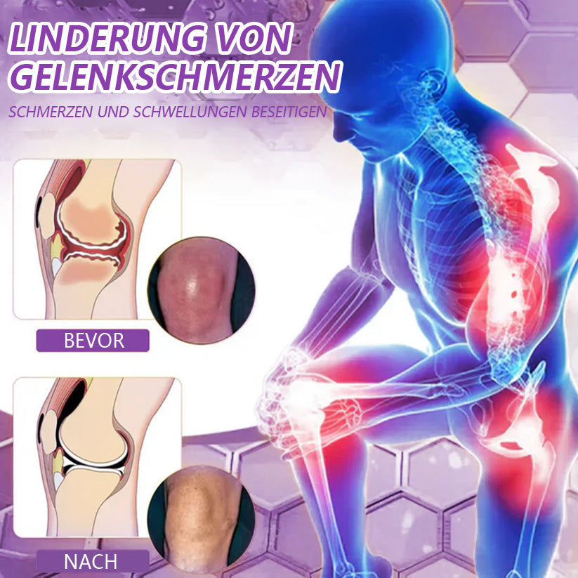 🚀 Schluss mit Lähmungsgefahr – Gelenk- und Knie-Gel👨⚕️