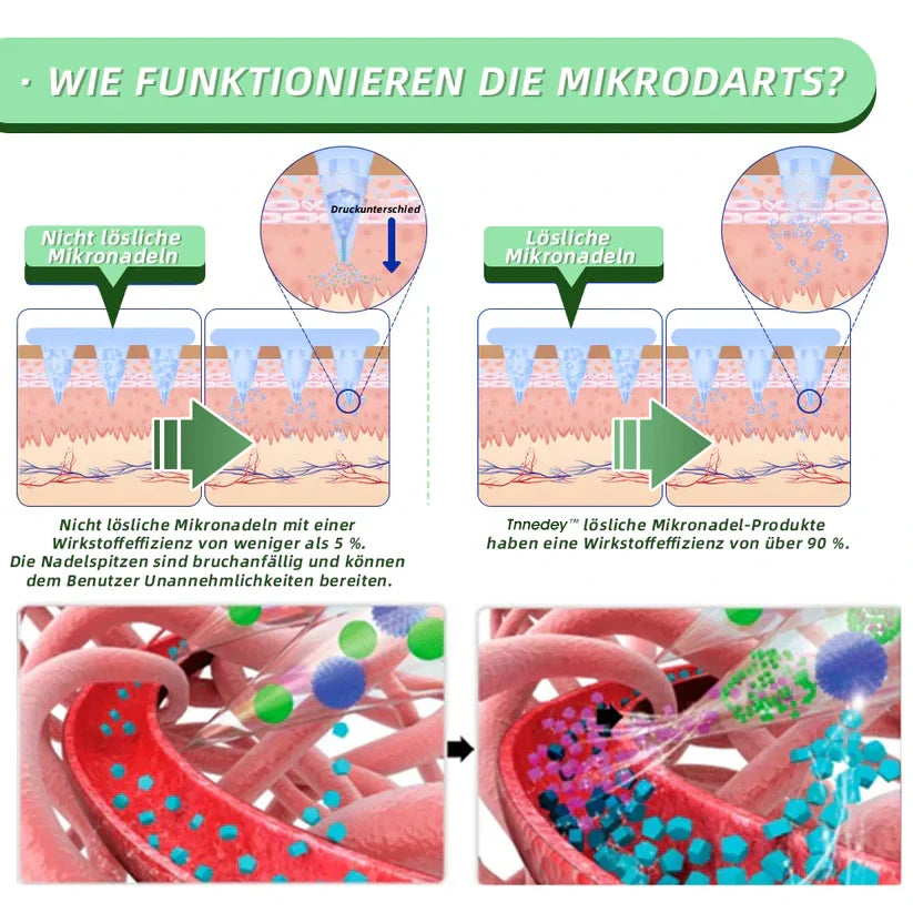 [7 Tage, um Ergebnisse zu sehen]  NEGUSY™SMGT-GLP-1 Nano-Mikronadel-Pflaster (Schmerzfrei, lang anhaltend, gegen Diabetes, Fettleibigkeit und Herz-Kreislauf-Erkrankungen)🌟