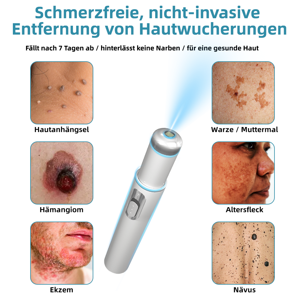 [𝗦𝗶𝗰𝗵𝘁𝗯𝗮𝗿𝗲 𝗘𝗿𝗴𝗲𝗯𝗻𝗶𝘀𝘀𝗲 𝗶𝗻 𝗻𝘂𝗿 𝟳 𝗧𝗮𝗴𝗲𝗻]👨‍⚕️ODALIT™ N𝐢ch𝐭-i𝐧va𝐬iv 𝐋𝐞b𝐞rfl𝐞ck- 𝐮𝐧𝐝 𝐖𝐚rz𝐞n𝐞n𝐭f𝐞r𝐧𝐮𝐧g𝐬-La𝐬𝐞r𝐬tift 𝐏𝐫o𝐦ox(𝗦𝗰𝗵𝗻𝗲𝗹𝗹𝗲 𝘂𝗻𝗱 𝘀𝗰𝗵𝗺𝗲𝗿𝘇𝗳𝗿𝗲𝗶𝗲 𝗘𝗻𝘁𝗳𝗲𝗿𝗻𝘂𝗻𝗴 𝘃𝗼𝗻 𝗪𝗮𝗿𝘇𝗲𝗻, 𝗠𝘂𝘁𝘁𝗲𝗿𝗺𝗮𝗹𝗲𝗻, 𝗔𝗹𝘁𝗲𝗿𝘀𝗳𝗹𝗲𝗰𝗸𝗲𝗻 𝘂𝗻𝗱 𝗛𝗮𝘂𝘁𝗮𝗻𝗵ä𝗻𝗴𝘀𝗲𝗹𝗻 – 𝗴𝗮𝗻𝘇 𝗼𝗵𝗻𝗲 𝗡𝗲𝗯𝗲𝗻𝘄𝗶𝗿𝗸𝘂𝗻𝗴𝗲𝗻)🫐