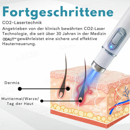 [𝗦𝗶𝗰𝗵𝘁𝗯𝗮𝗿𝗲 𝗘𝗿𝗴𝗲𝗯𝗻𝗶𝘀𝘀𝗲 𝗶𝗻 𝗻𝘂𝗿 𝟳 𝗧𝗮𝗴𝗲𝗻]👨‍⚕️ODALIT™ N𝐢ch𝐭-i𝐧va𝐬iv 𝐋𝐞b𝐞rfl𝐞ck- 𝐮𝐧𝐝 𝐖𝐚rz𝐞n𝐞n𝐭f𝐞r𝐧𝐮𝐧g𝐬-La𝐬𝐞r𝐬tift 𝐏𝐫o𝐦ox(𝗦𝗰𝗵𝗻𝗲𝗹𝗹𝗲 𝘂𝗻𝗱 𝘀𝗰𝗵𝗺𝗲𝗿𝘇𝗳𝗿𝗲𝗶𝗲 𝗘𝗻𝘁𝗳𝗲𝗿𝗻𝘂𝗻𝗴 𝘃𝗼𝗻 𝗪𝗮𝗿𝘇𝗲𝗻, 𝗠𝘂𝘁𝘁𝗲𝗿𝗺𝗮𝗹𝗲𝗻, 𝗔𝗹𝘁𝗲𝗿𝘀𝗳𝗹𝗲𝗰𝗸𝗲𝗻 𝘂𝗻𝗱 𝗛𝗮𝘂𝘁𝗮𝗻𝗵ä𝗻𝗴𝘀𝗲𝗹𝗻 – 𝗴𝗮𝗻𝘇 𝗼𝗵𝗻𝗲 𝗡𝗲𝗯𝗲𝗻𝘄𝗶𝗿𝗸𝘂𝗻𝗴𝗲𝗻)🫐