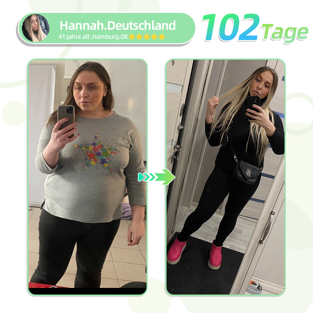 [7 Tage, um Ergebnisse zu sehen]  NEGUSY™SMGT-GLP-1 Nano-Mikronadel-Pflaster (Schmerzfrei, lang anhaltend, gegen Diabetes, Fettleibigkeit und Herz-Kreislauf-Erkrankungen)🌟